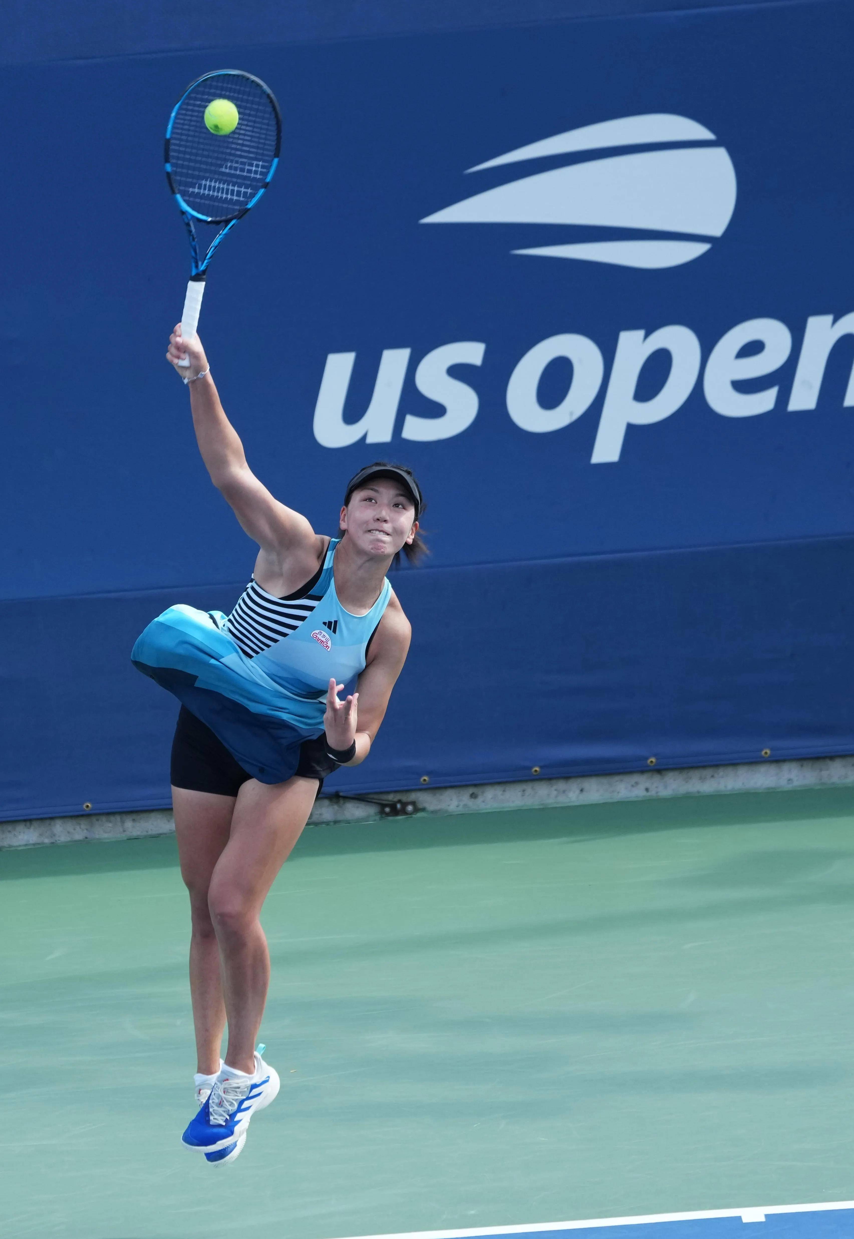 慢性疲劳 慢性疲劳